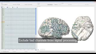 cortiQ  rapid cortical mapping [upl. by Edyth]