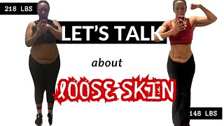 The TRUTH About Loose Skin After Weight Loss  Before amp After [upl. by Esme808]