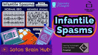 Infantile Spasms [upl. by Tham]