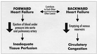 Differences between Forward Heart Failure and Backward Heart Failure [upl. by Eelyr]