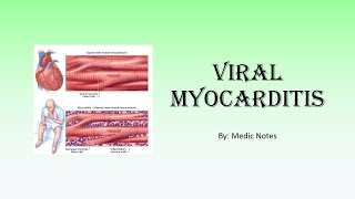 Viral myocarditis  causes Lake Louise criteria clinical features investigations treatment [upl. by Ynatsyd]