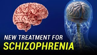 New Treatment for Schizophrenia [upl. by Arihsak779]