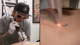 Professionals Warn Against Using AtHome Tattoo Kits [upl. by Alracal445]