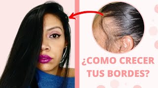 Cómo hacer CRECER el CABELLO de las ENTRADAS  RECUPERA EL PELO de LAS SIENES y zonas despobladas [upl. by Nesiaj850]