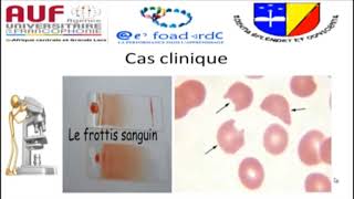 MORPHOLOGIE EN HEMATOLOGIE EPISODE 8 [upl. by Puri]