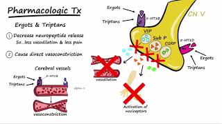 Migraines  Pathophysiology amp Treatment Described Concisely [upl. by Batsheva]