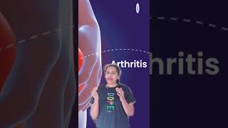 Part1 Rheumatoid Arthritis Causes and effects health healthylifestyle facts viral shortsfeed [upl. by Faunie]