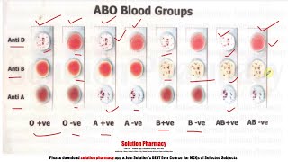 Blood Group Test  Determination of Blood Group  All Blood Group  Testing Blood Group  ENGLISH [upl. by Liryc677]