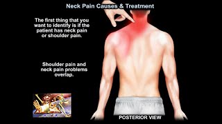 Neck Pain Causes and Treatment  Everything You Need To Know  Dr Nabil Ebraheim [upl. by Yarahs950]