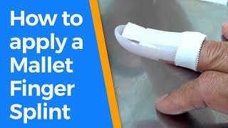 How to apply a Mallet Finger Splint [upl. by Thibaud]