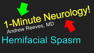 1Minute Neurology Hemifacial Spasm [upl. by Amargo]