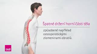 Spinomed® – princip biologické zpětné vazby [upl. by Anivas]