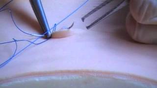 Subcuticular Suture Technique [upl. by Elocal]