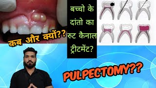 बच्चो के दांतो को बचाने का इलाज pulpectomy How to save childs tooth [upl. by Yllier]