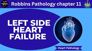 Left side Heart FailureRobbins pathology chapter 11Heart pathology pathology robbins heart [upl. by Heddi]