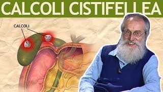 Dott Mozzi Calcoli alla cistifellea biliari colecisti [upl. by Atyekram]