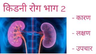 किडनी रोग सम्बन्धी जानकारीkidney disease in Nepali [upl. by Mor641]