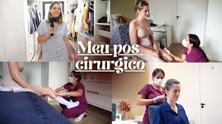 Como está sendo a minha recuperação pós abdominoplastia [upl. by Elva]