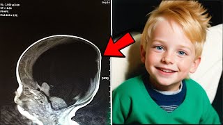 RICORDATE IL BAMBINO NATO SENZA CERVELLO ECCO COME APPARE A 9 ANNI DALLA NASCITA [upl. by Jarrod411]