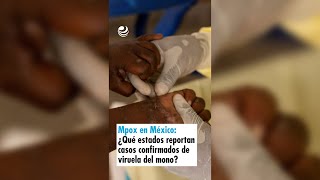 Mpox en México ¿Qué estados ya reportan casos confirmados de viruela del mono [upl. by Estevan]