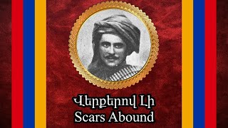 Scars Abound  Վերքերով Լի  Verkerov Li [upl. by Spiegelman777]