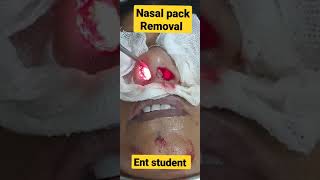 Anterior Nasal Packing [upl. by Dinah]