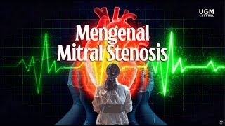 Mengenal Mitral Stenosis [upl. by Seluj]