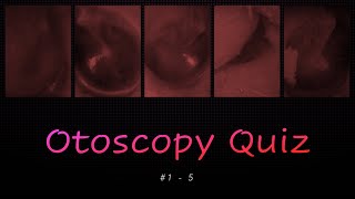 Otoscopy Quiz 1  5 [upl. by Refinnej]