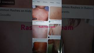 Rash free cream uses itching rashes allergy vasunthacreations [upl. by Assilym]