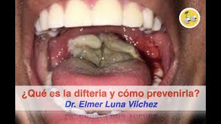 ¿QUÉ ES LA DIFTERIA Y CÓMO PREVENIRLA  Dr Elmer H Luna Vilchez [upl. by Robinett]