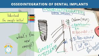 osseointegration of dental implants Part  2 [upl. by Yarvis742]