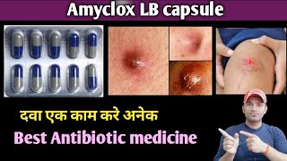 Amyclox LB capsule use dose benefits and side effects full review in hindi [upl. by Etam]