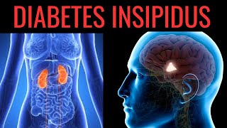 What is Diabetes Insipidus Symptoms Causes Treatment [upl. by Cully179]