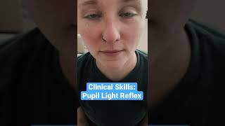 Pupil Light Reflex Clinical Skills  LevelUpRN [upl. by Anilatac]