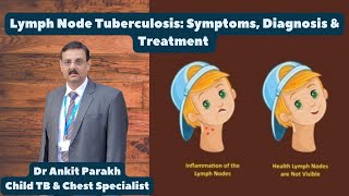 Extrapulmonary tuberculosis  A challenging diagnosis [upl. by Wolbrom]