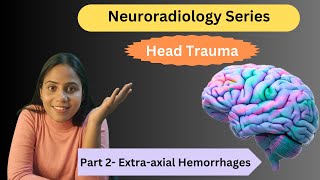 Extraaxial Hemorrhages  Head Trauma Part 2  Neuroradiodiology  Dr Somlina Dutta [upl. by Suu]