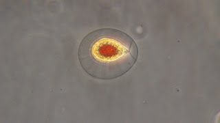 Haematococcus pluvialis the green algae that turn red [upl. by Philemol608]