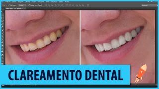 Como Clarear os Dentes  Photoshop CC [upl. by Tteragram]