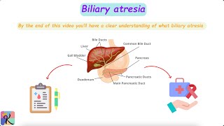 Understanding Biliary Atresia – Causes Diagnosis and Treatment [upl. by Lorenzana]