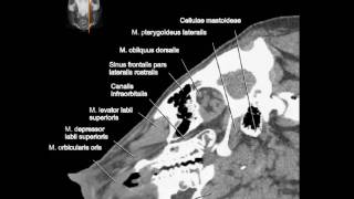 Virtual Pig Head  CT scan  sagittal slice animation [upl. by Shanta]