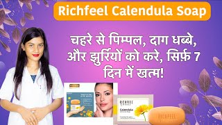 Richfeel Calendula Soap for Acne  Richfeel Calendula Soap Review  Benefits  Side Effects [upl. by Adrea]