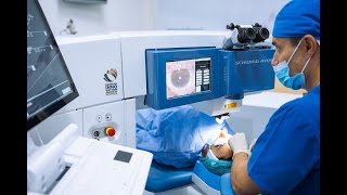 Prednosti SmartFEMTO LASIK procedure laserskog skidanja dioptrije [upl. by Hopper]