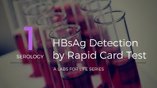 HBsAg Detection by Rapid Card Test [upl. by Acsirp813]