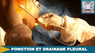 Ponction et drainage pleural [upl. by Atteroc]