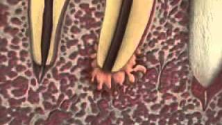 Root canal therapy dentist castle hill toothache tooth pain dental painflv [upl. by Ellehcyar]