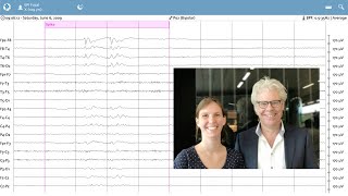 Artificial intelligence for EEG [upl. by Notniw670]