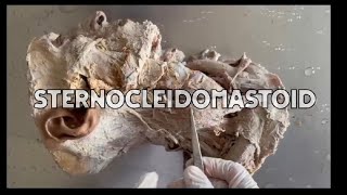 Muscle of head and neck sternocleidomastoid muscle hnf dissection anatomy [upl. by Aiceled]