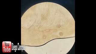 movement of Trichinella spiralis larva within muscle on the microscopic slide [upl. by Elpmet]