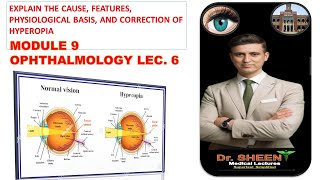 EXPLAIN THE CAUSE FEATURES PHYSIOLOGICAL BASIS AND CORRECTION OF HYPEROPIA [upl. by Coughlin]