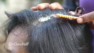 Oddly Satisfying Insane Dandruff Scratching Flakes Scalp Condition Removal After Braids 𝐈𝐌𝐃𝟑𝟗𝟗𝟎𝟗𝟕𝟎 [upl. by Ahcsatan666]